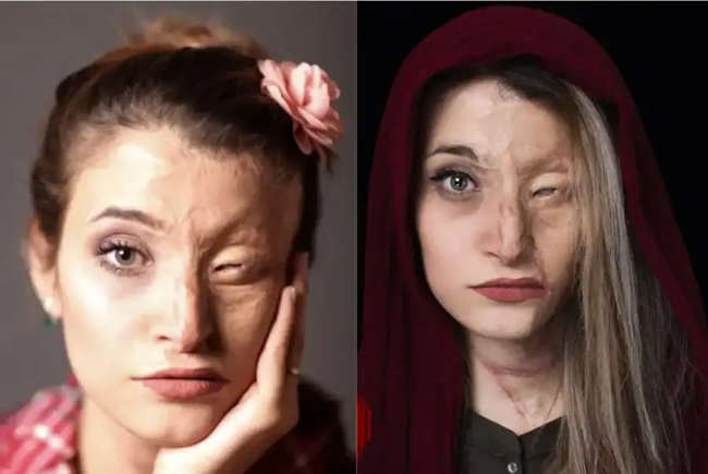 Vítima da ditadura do Irã narra momentos de terror do regime islâmico: “Fui torturada por me recusar a colocar um véu na cabeça”