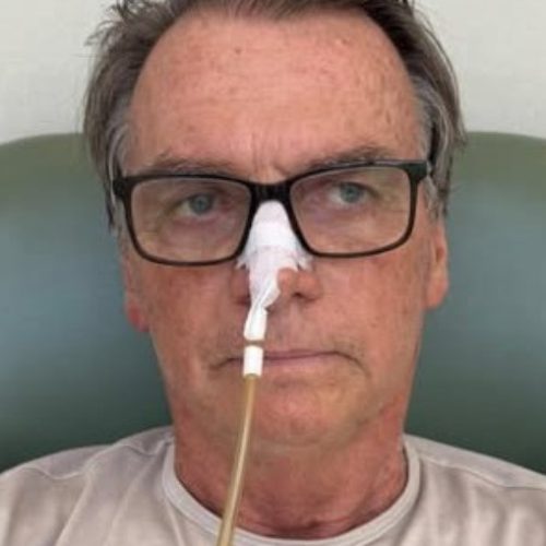 Na UTI, Bolsonaro tem alterações no fígado