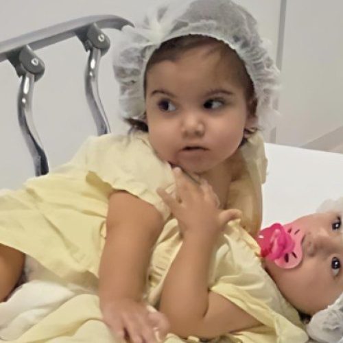 Separação de siamesas mobiliza 60 profissionais por 19 horas