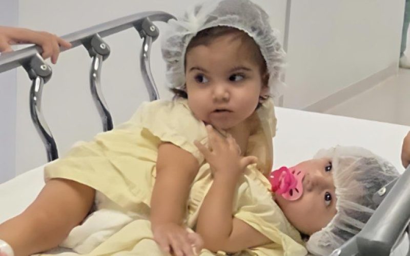 Separação de siamesas mobiliza 60 profissionais por 19 horas