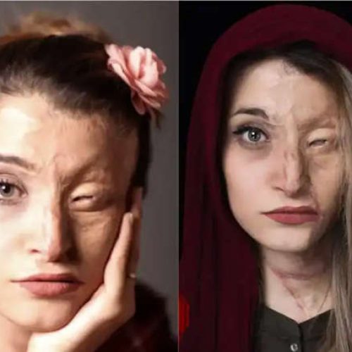 Vítima da ditadura do Irã narra momentos de terror do regime islâmico: “Fui torturada por me recusar a colocar um véu na cabeça”