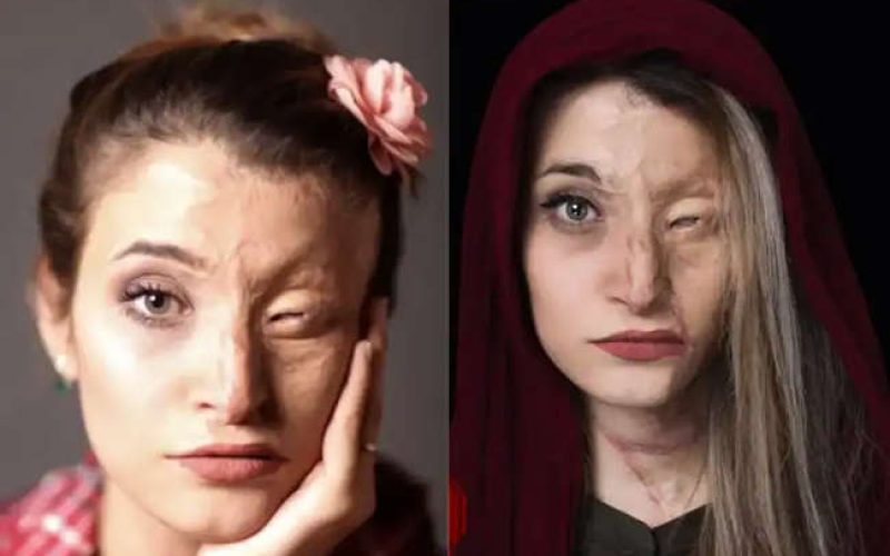 Vítima da ditadura do Irã narra momentos de terror do regime islâmico: “Fui torturada por me recusar a colocar um véu na cabeça”