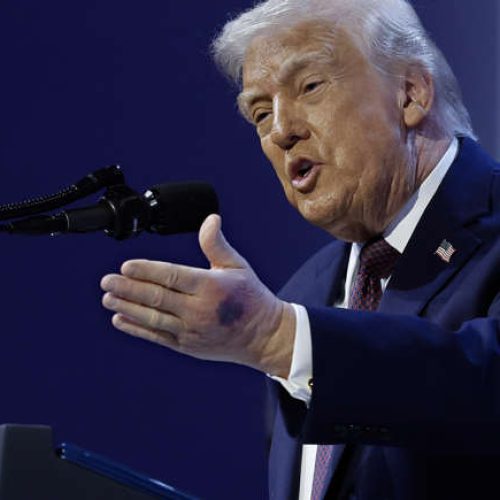 O que é a doença de Trump?