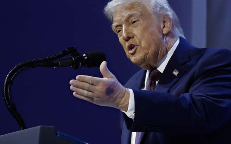 O que é a doença de Trump?