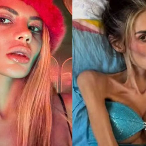 Influencer morre com 22 kg após descobrir distúrbio alimentar