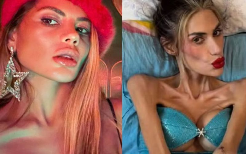 Influencer morre com 22 kg após descobrir distúrbio alimentar